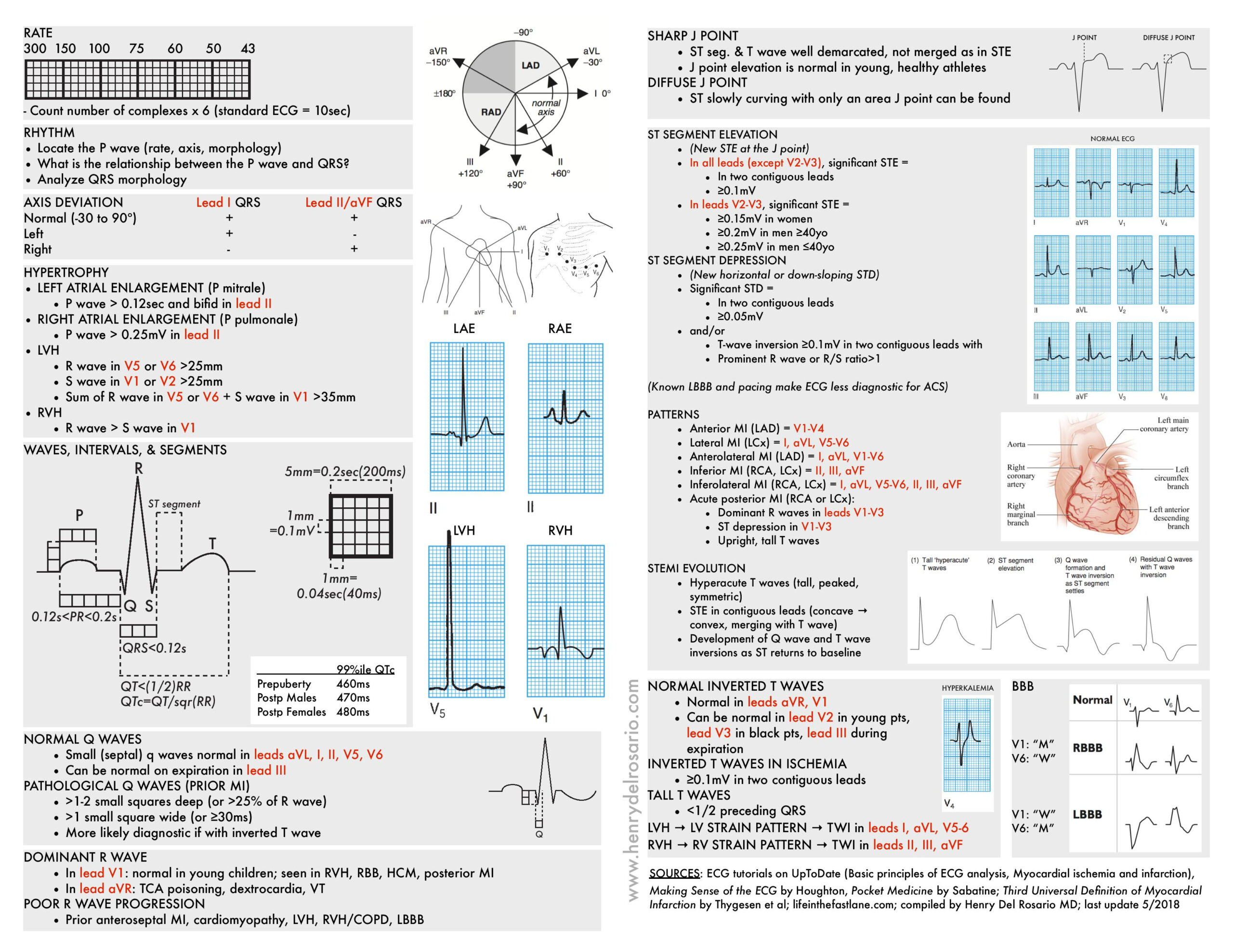 Ecg Cheat Sheet Ecg Rapid View: It Is Organized | Grepmed regarding Free Printable Ekg Interpretation Cheat Sheet