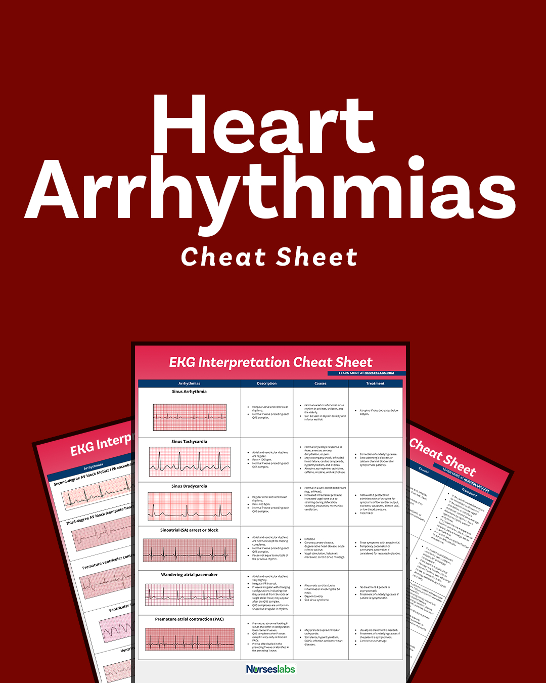 Ekg Interpretation Cheat Sheet &amp;amp; Heart Arrhythmias Guide (2020 Update) intended for Free Printable Ekg Interpretation Cheat Sheet
